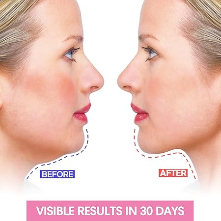 V Shape Face Slimming Strap